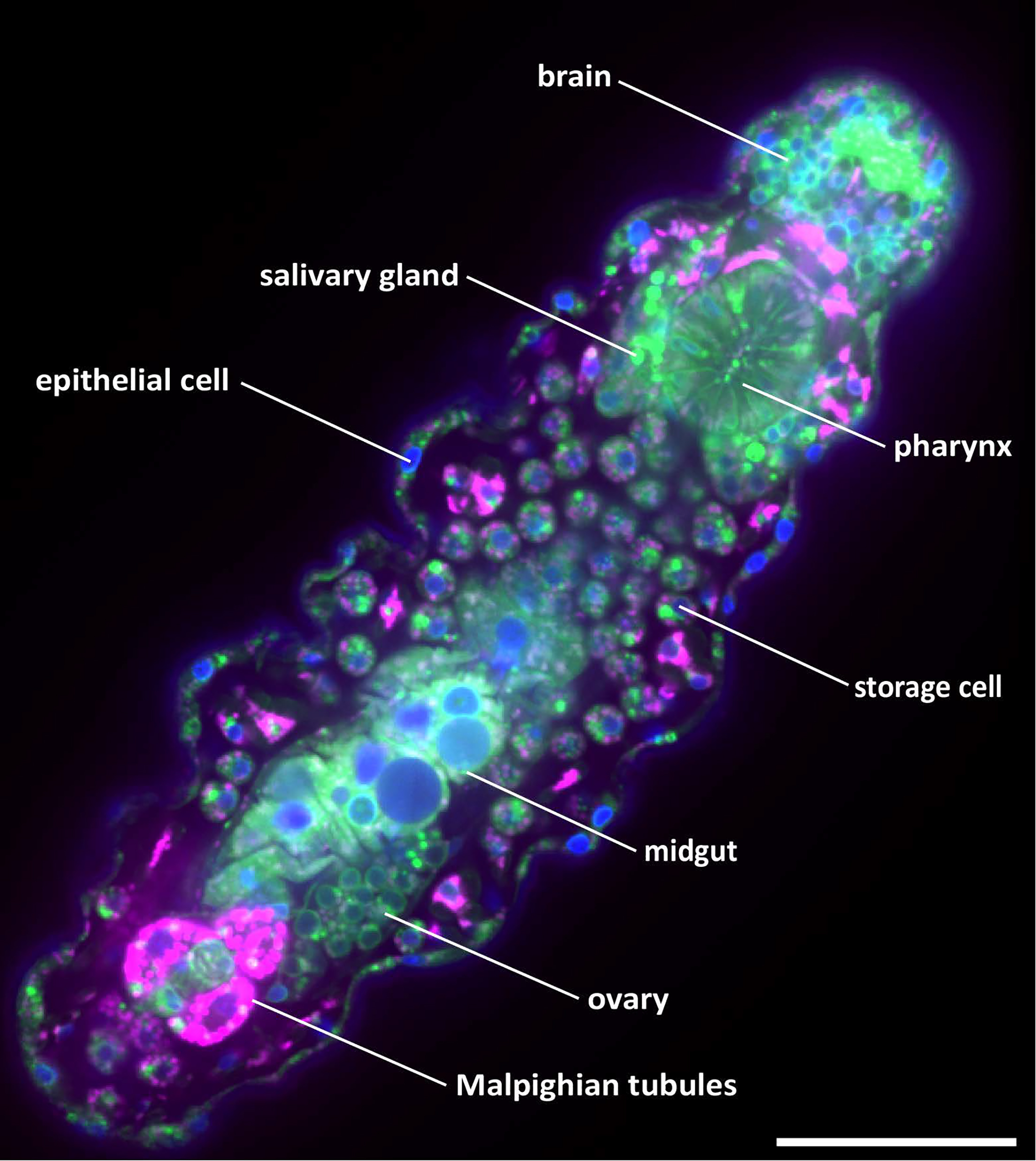 Stained Tardigrade