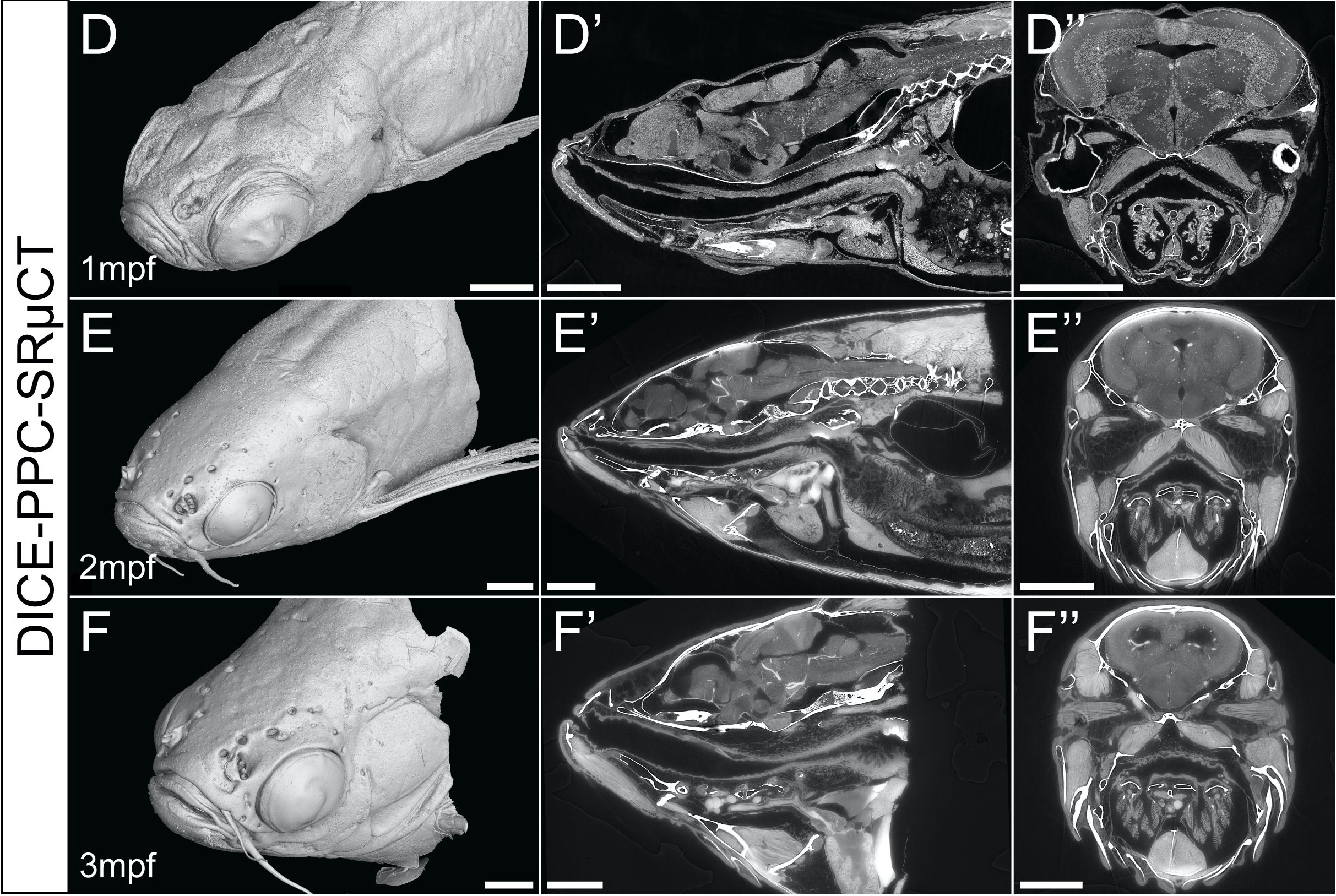 Enhanced contrast synchrotron X-ray microtomography for describing skeleton-associated soft tissue defects in zebrafish mutants