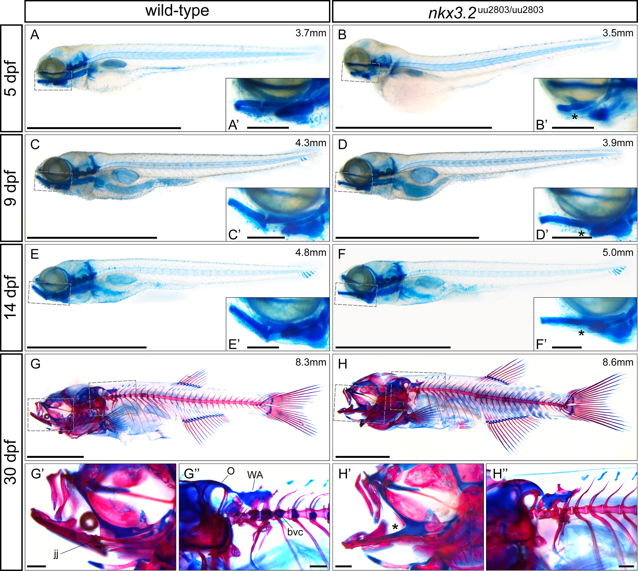The Broad Role of Nkx3.2 in the Development of the Zebrafish Axial Skeleton